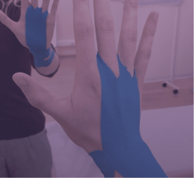 ТЕЙПИРОВАНИЕ